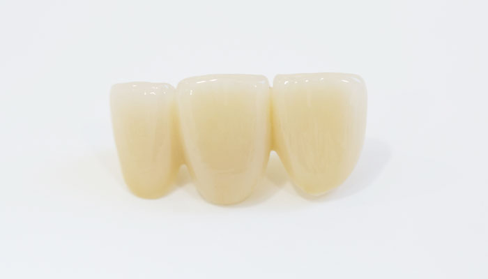 前歯の治療